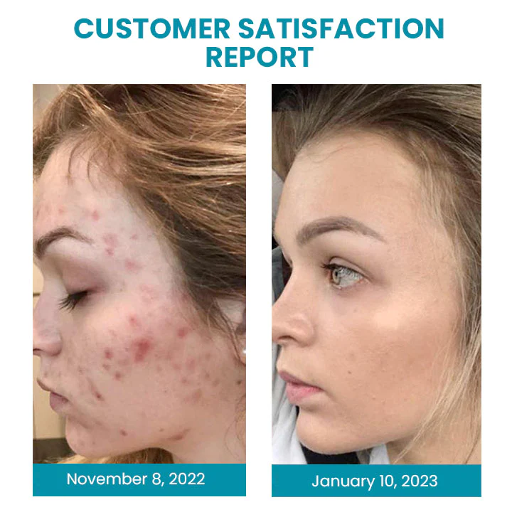 Oveallgo Anahita Japan Oligopeptide Pores Contraction Essence