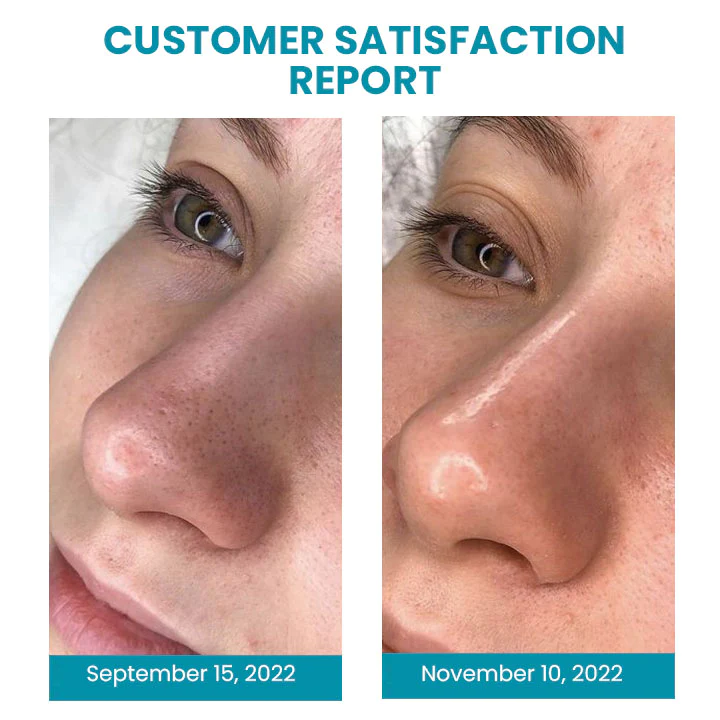 Oveallgo Anahita Japan Oligopeptide Pores Contraction Essence