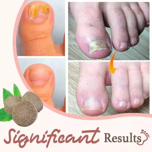 Anti-Fungal Exfoliating Foot Soak