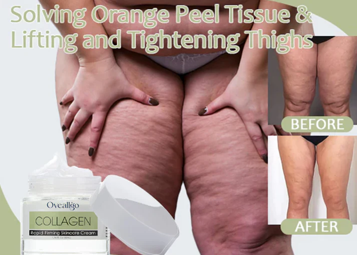 Oveallgo Collagen Boost Rapid Firming&Lifting Cream