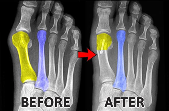 FeetTreat Orthopedic Compression Socks