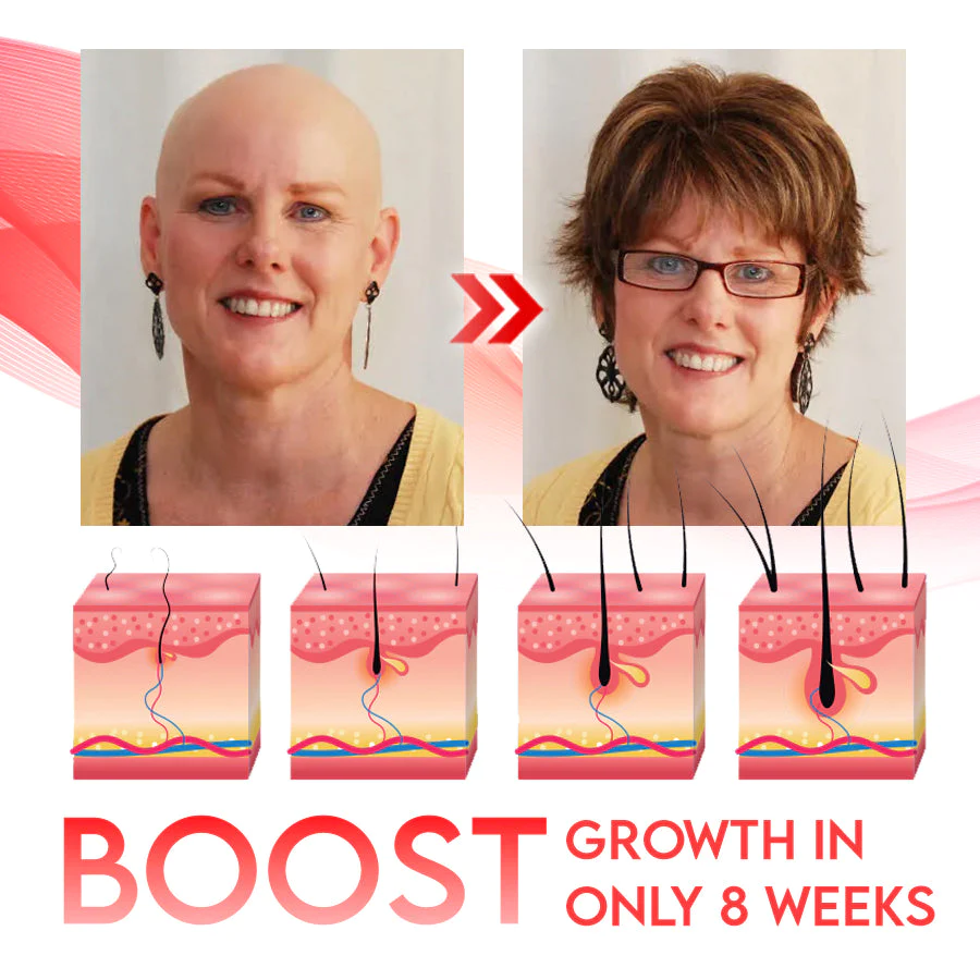 RedGRO Onion Hair Nutrition Spray