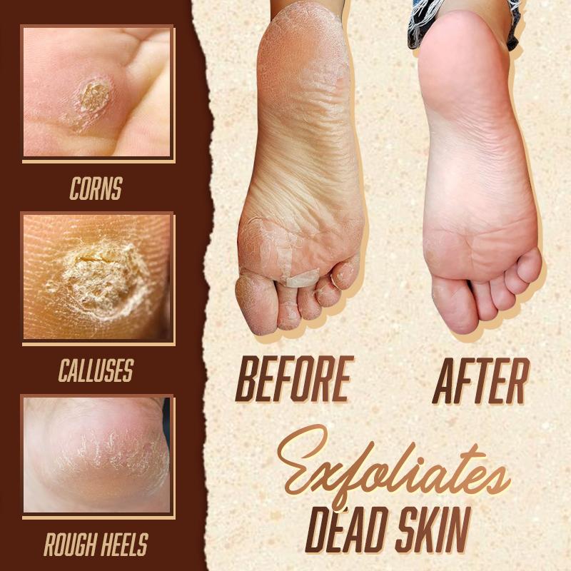 Anti-Fungal Herbal Foot Soak