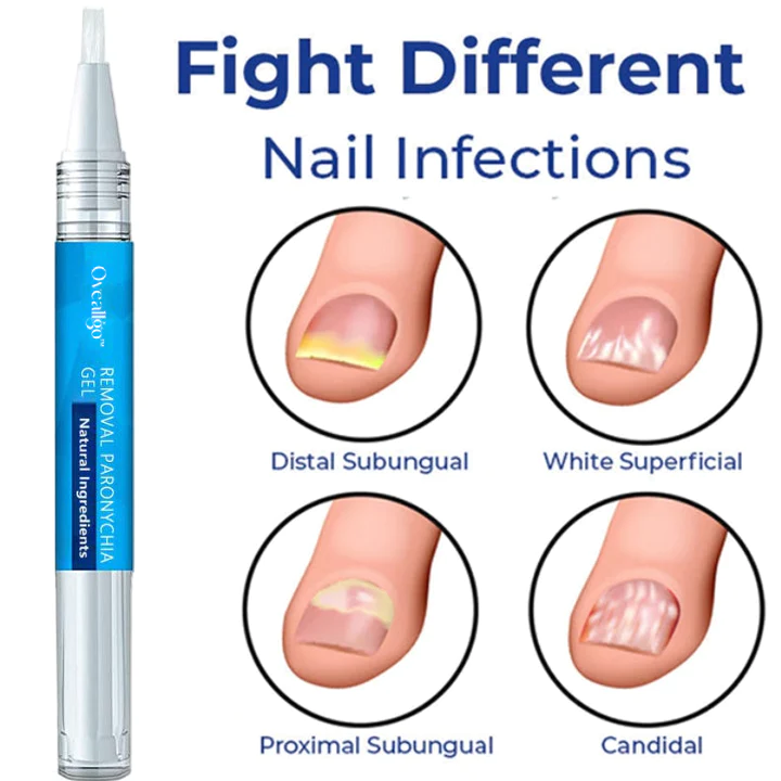 Oveallgo Removal Paronychia Gel