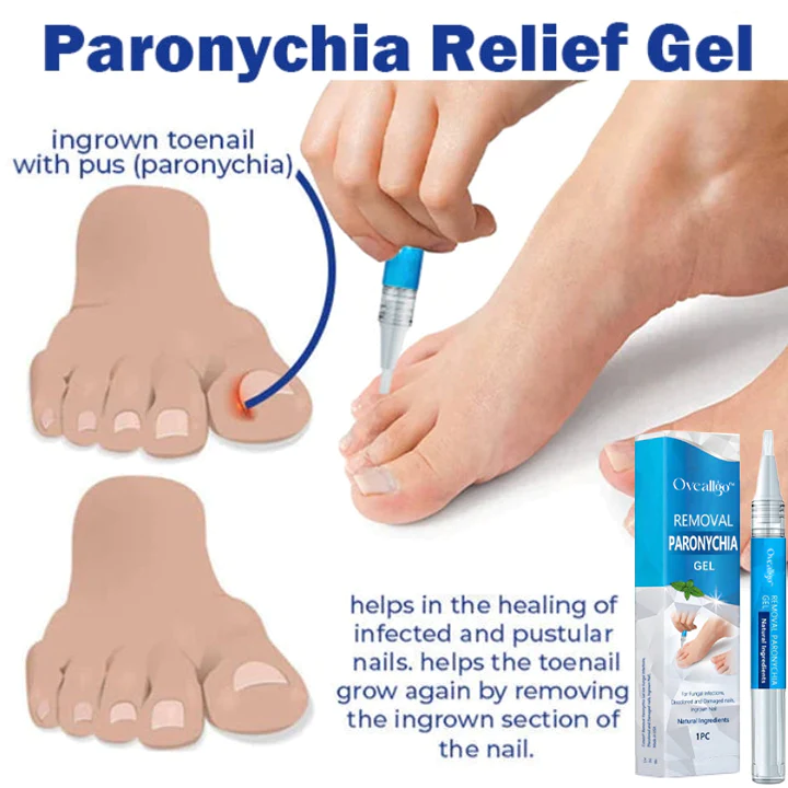 Oveallgo Removal Paronychia Gel
