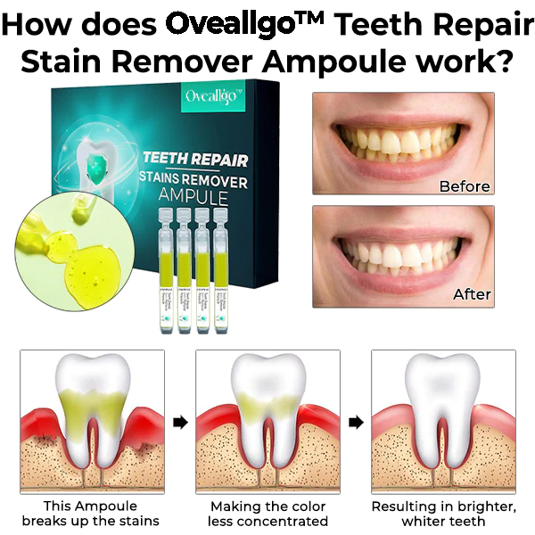 Oveallgo Teeth Repair Stain Remover Ampoule