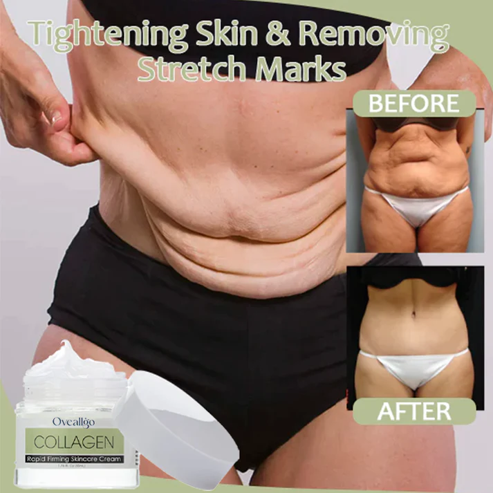 Oveallgo Collagen Boost Rapid Firming&Lifting Cream