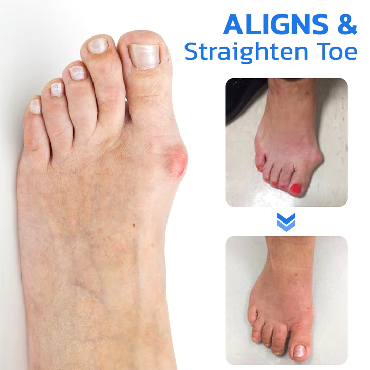 GFOUK ToebeJoin Correct Pression Patch