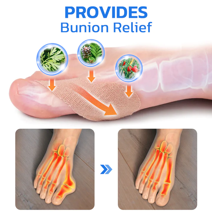 GFOUK ToebeJoin Correct Pression Patch
