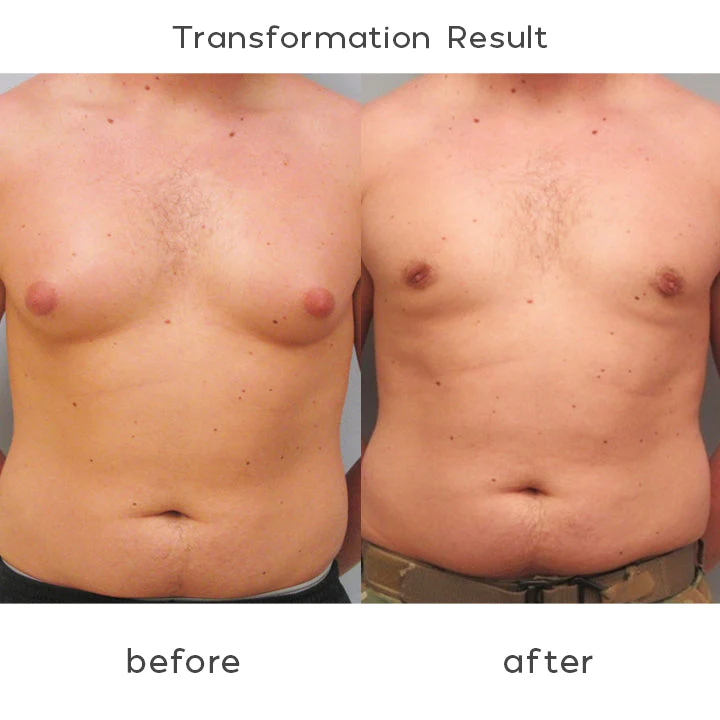 PecBuilder EMS Chest Trainer for Men