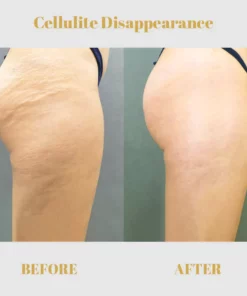 Fivfivgo Collagen Buttock Enlargement Patch