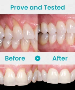 Awzlove Gum Shield Therapy Gel