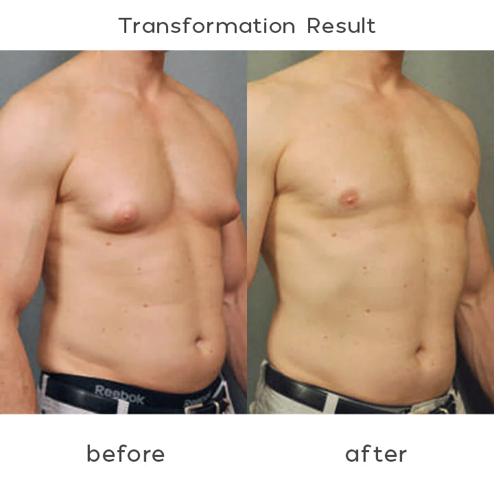 PecBuilder EMS Chest Trainer for Men