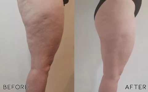 Oveallgo Avocado Ageless Body Cream Scrub