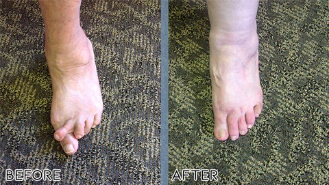 Oveallgo Bee Sting Joint and Bone Therapy Cream