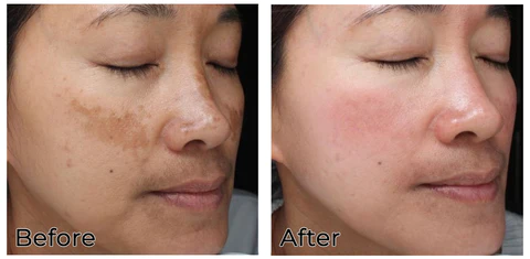 Turmeric Dark Spot Corrector Face Serum