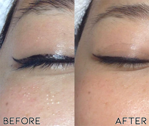 flysmus Milk Spots Treatment Essence