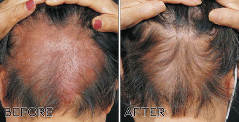 Fivfivgo Olive Hair Scalp Repair Spray