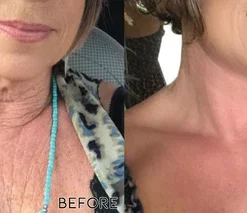 Oveallgo Neck Tightening Roller