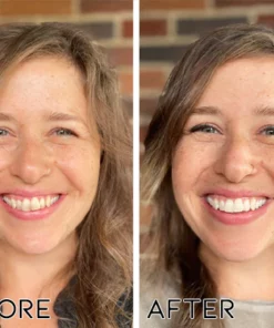 Oveallgo Teeth Repair Stain Remover Ampoule