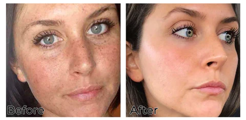 Turmeric Dark Spot Corrector Face Serum