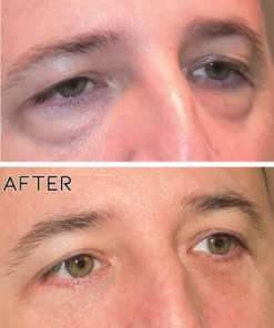 Oveallgo Men Expert Hydra Energetic Eye Roller