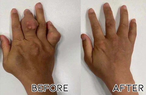 Oveallgo Bee Sting Joint and Bone Therapy Cream