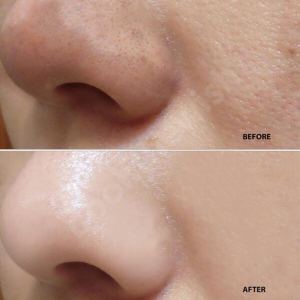 Black Mask  Peel off Mask