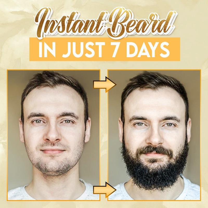 BaldFix Strong Hair Regrowth Serum (¨50%OFF)