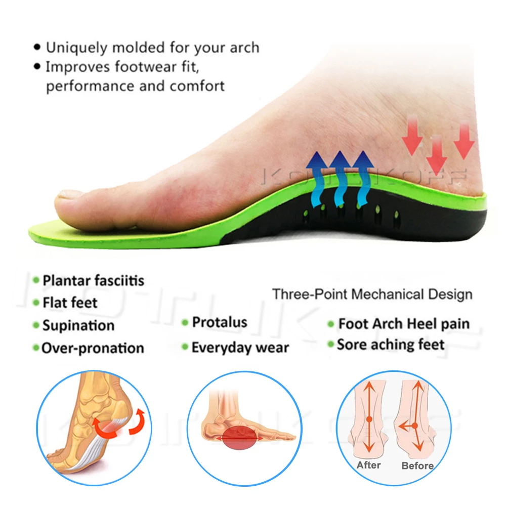 Orthopedic Xstance Insoles