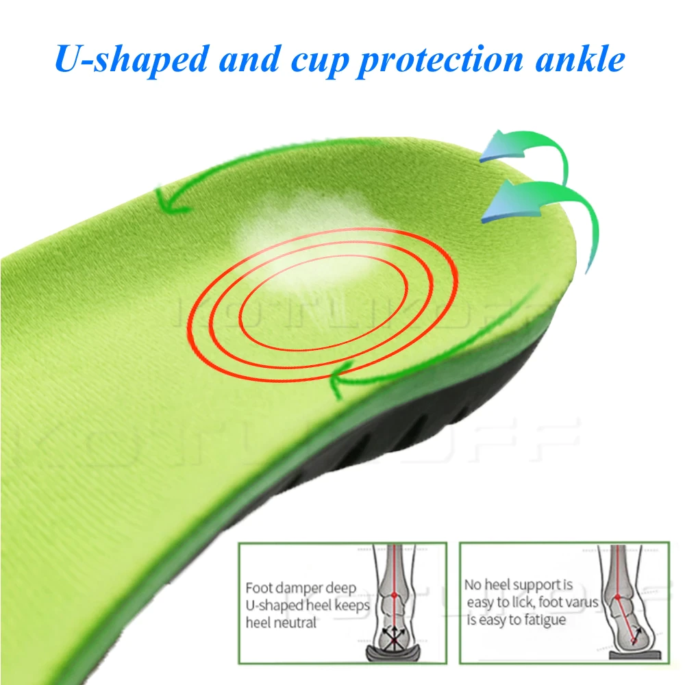 Orthopedic Xstance Insoles
