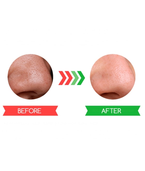 Black Mask  Peel off Mask