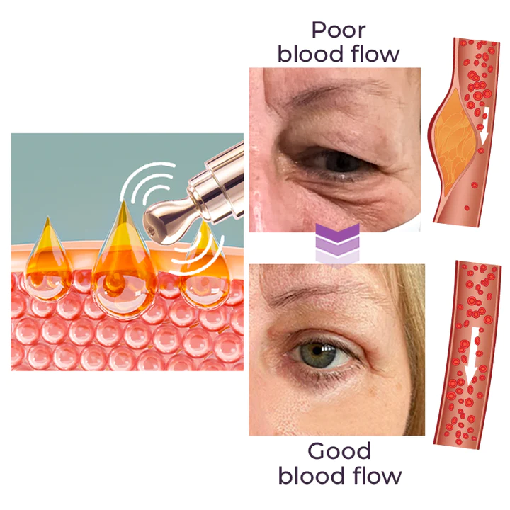 Oveallgo Milk Spots Therapy Electric Serum Pen