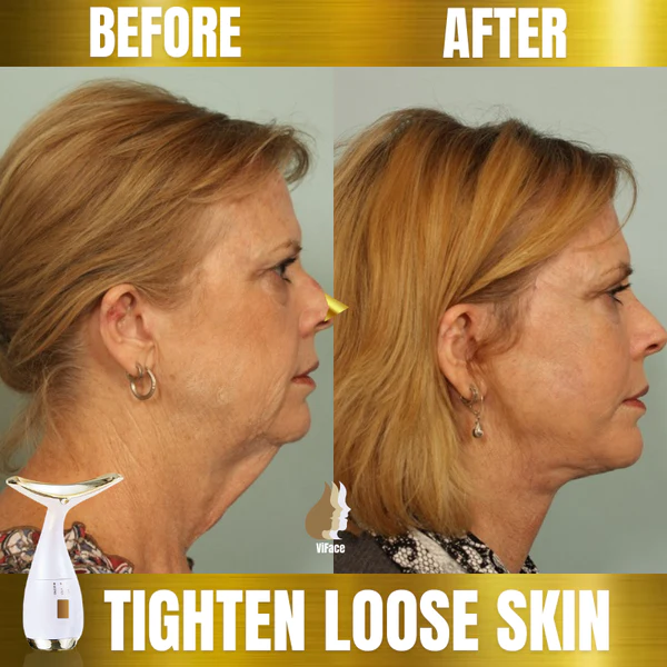 AEXZR Ultrasonic Facial Lifting Massager