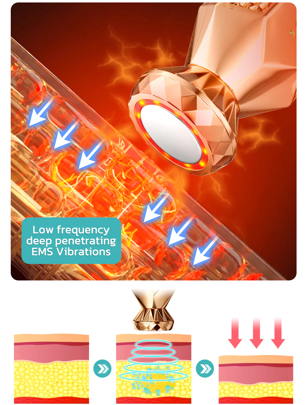 GFOUK Microcurrent Cryolipolysis Mini Massage Device