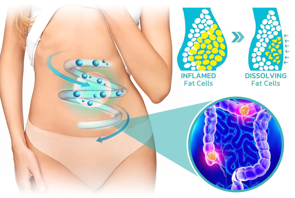 GFOUK Microcurrent Cryolipolysis Mini Massage Device