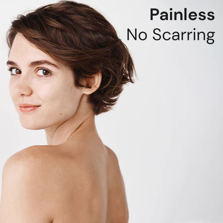 Oveallgo WartsOff NanoPURI Instant Blemish Removal Cream