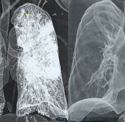 WE.Vitality Lung and Airway Care Wellness Spray