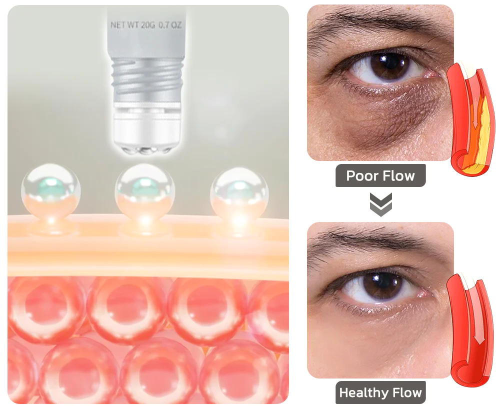 Ceoerty Milia Erase Lifting Eye Gel