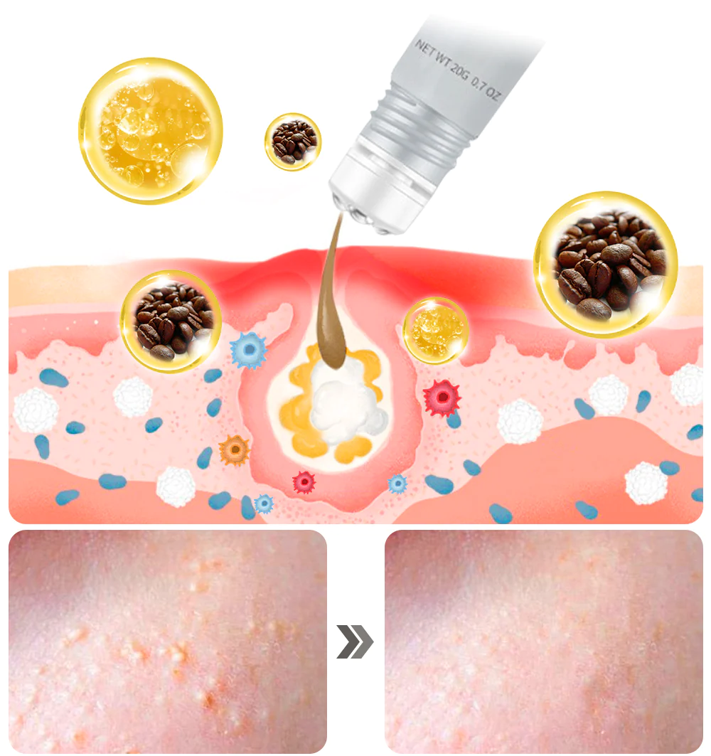 Ceoerty Milia Erase Lifting Eye Gel