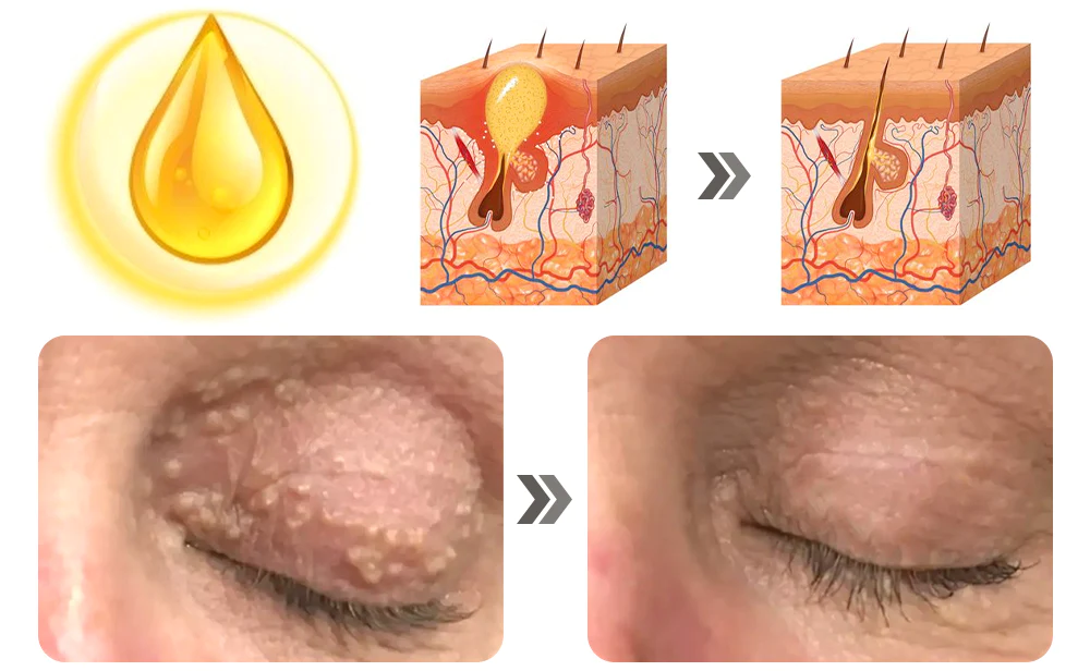 Ceoerty Milia Erase Lifting Eye Gel