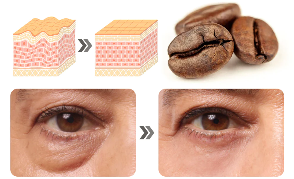 Ceoerty Milia Erase Lifting Eye Gel