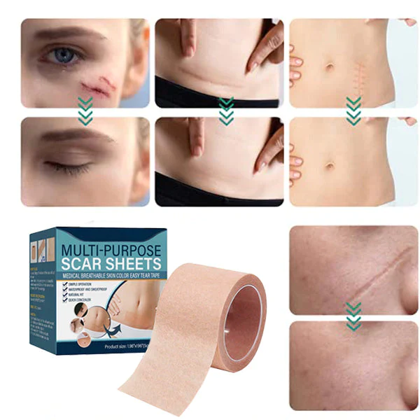 ELAIMEI Medical Soft Silicone Gel Tape for Scar Removal