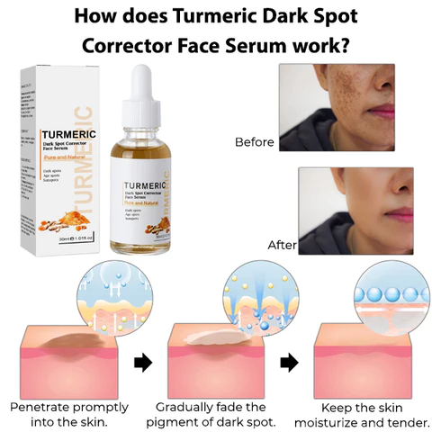 Turmeric Dark Spot Corrector Face Serum