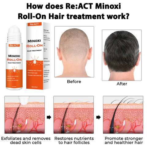 ReACT Minoxi Roll-On Hair Treatment