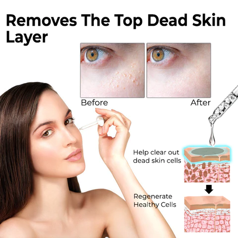 flysmus Milk Spots Treatment Essence