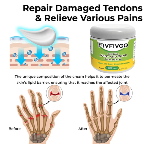 Oveallgo Bee Sting Joint and Bone Therapy Cream