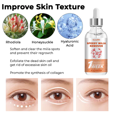 flysmus Milk Spots Treatment Essence