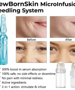 NewBornSkin MicroInfusion Needling System