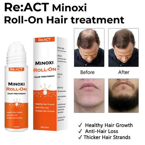 ReACT Minoxi Roll-On Hair Treatment